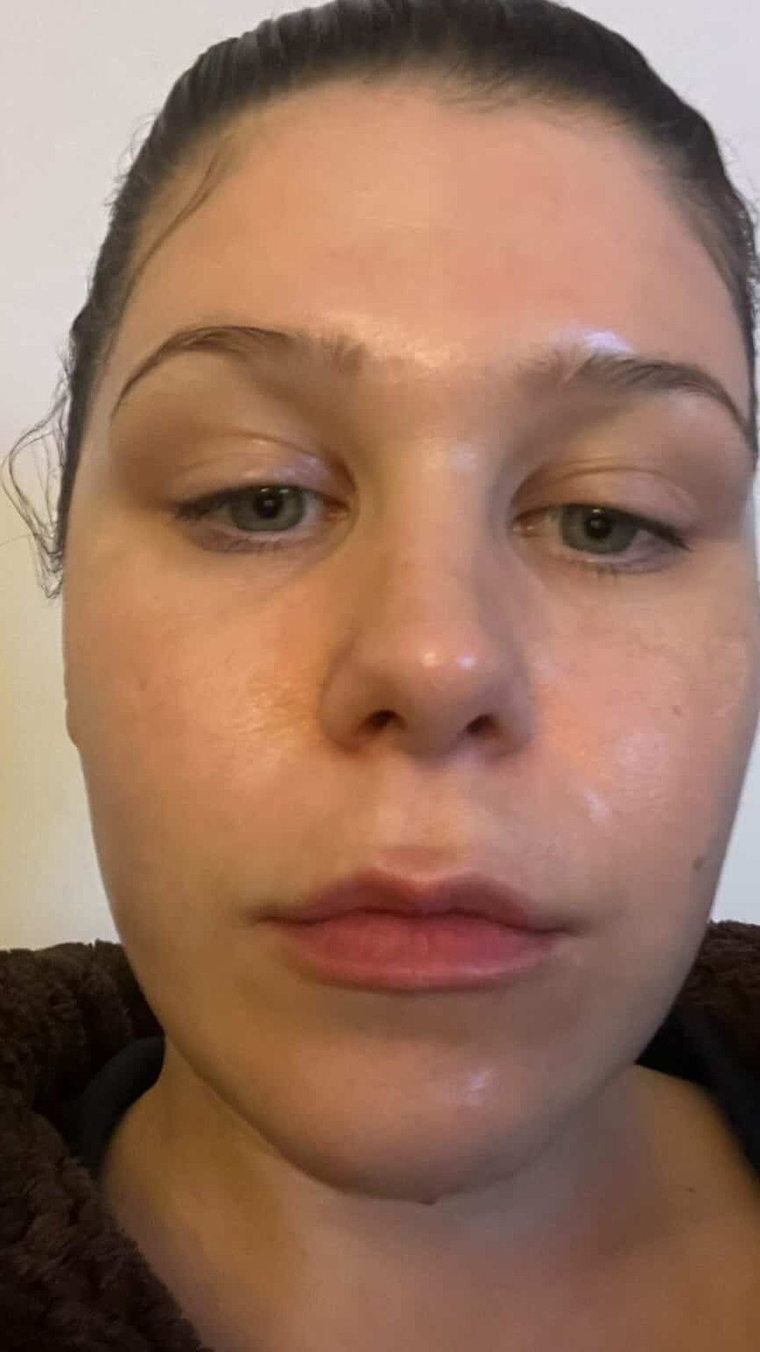 Gee M. after one night with NOOKS Gee M. after one night with NOOKS, skin calm and even