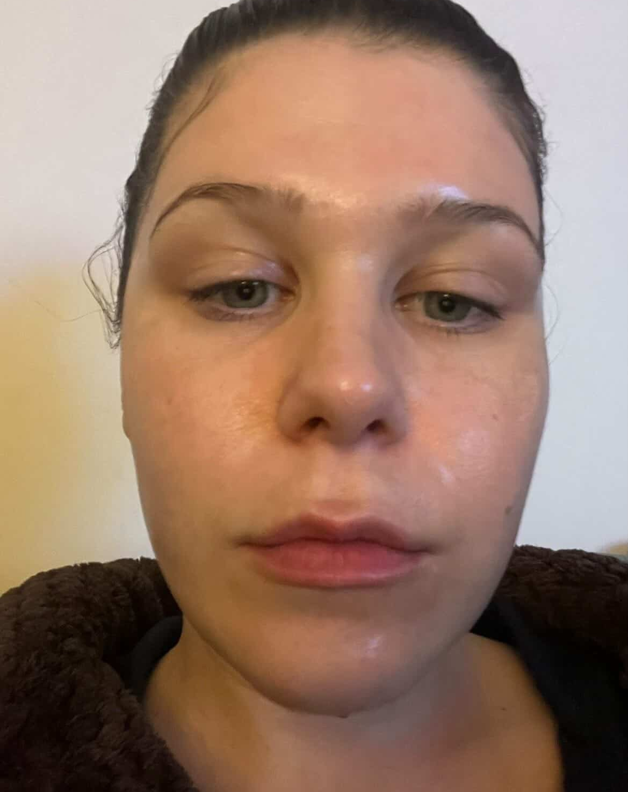 Same skin, after