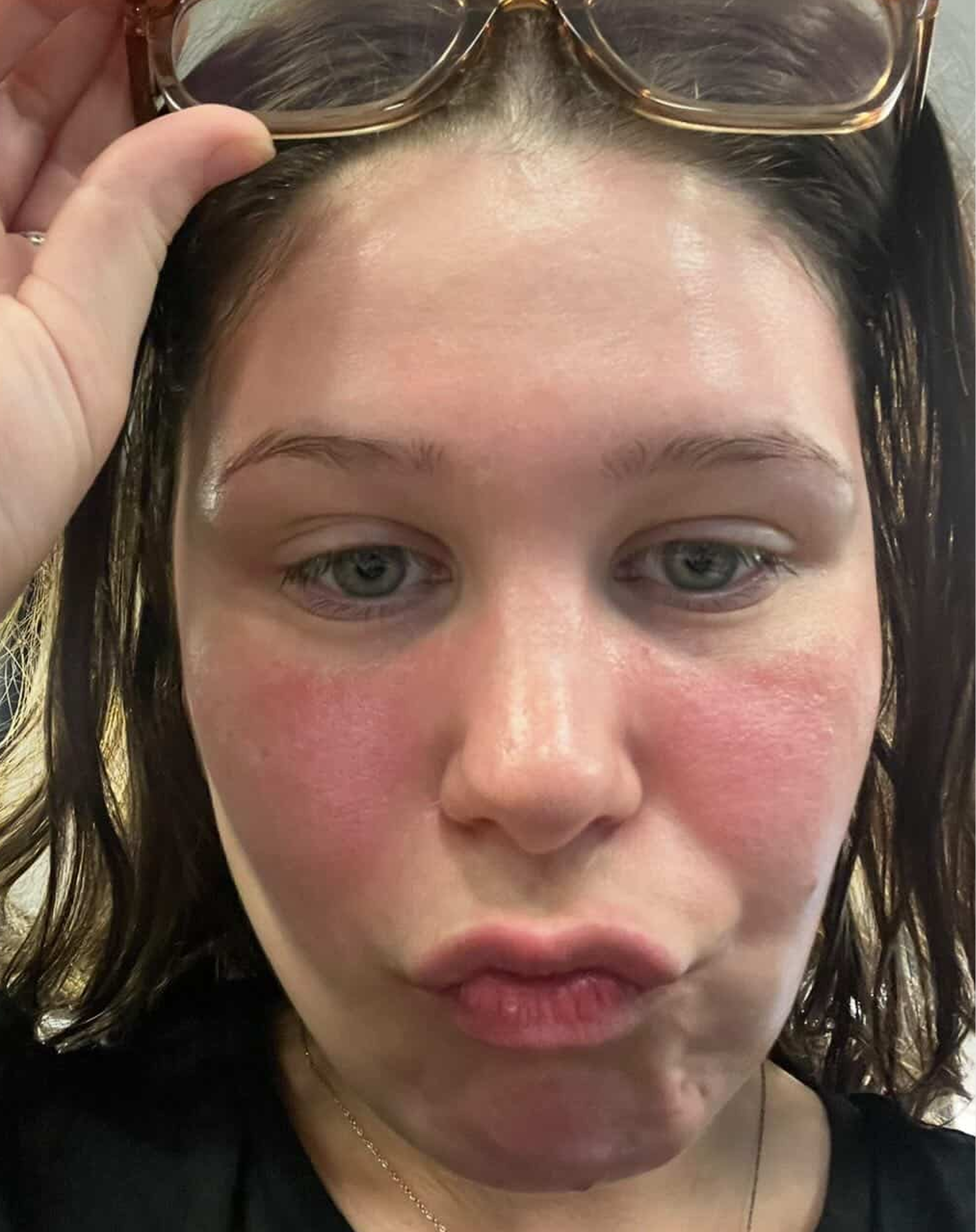 Reactive skin, before